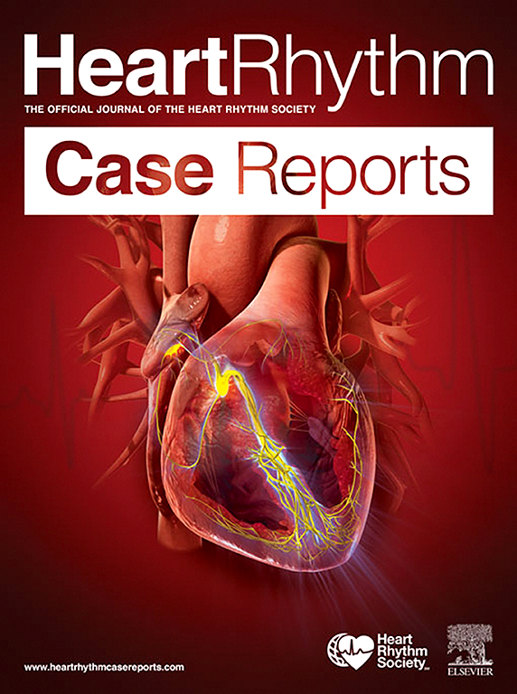Go to journal home page - HeartRhythm Case Reports